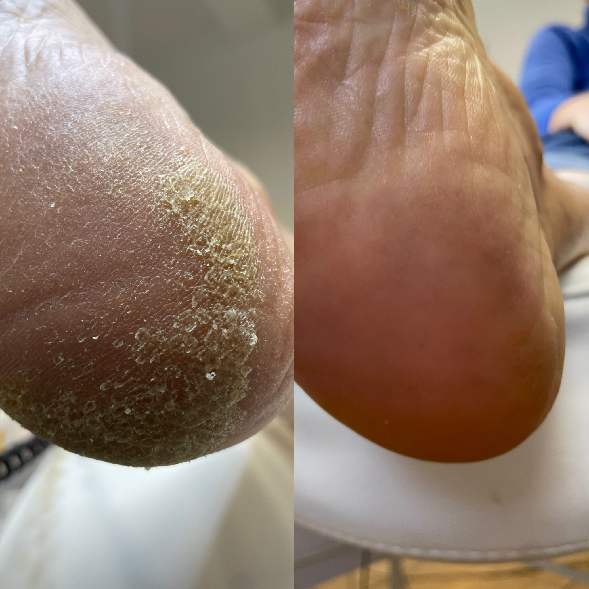 E1DACD87-72EF-4418-BD35-3BC502AECA68